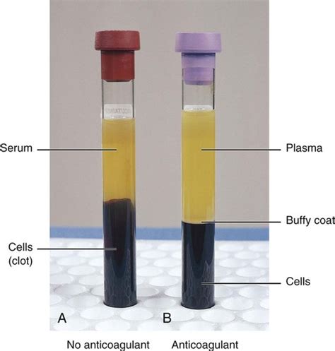 which of the following is true of a serum specimen